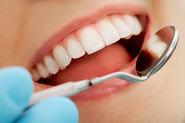 Teeth Whitening Options From A Cosmetic Dentist In Rockville