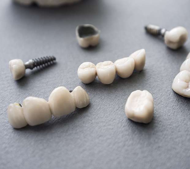 Rockville The Difference Between Dental Implants and Mini Dental Implants